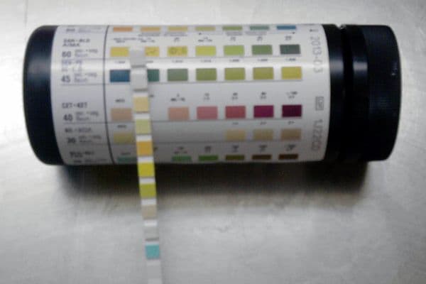 Urine test for river blindness