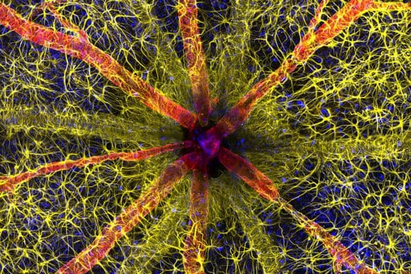 Global win for Australian retinal image (1)