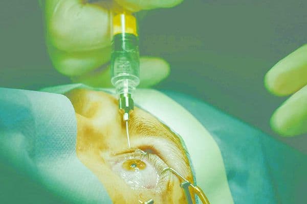 Aflibercept ‘safe’ in HTLV-1-infected eyes