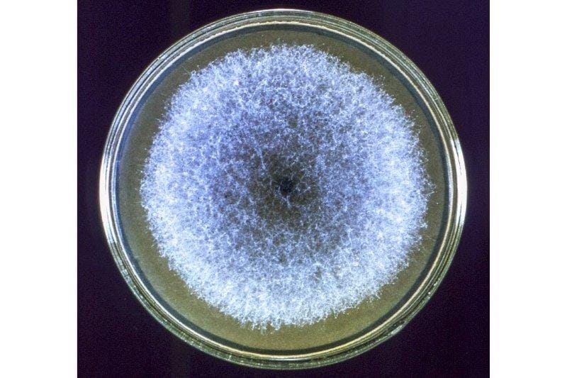 eye like petri dish flora microbes bacteria online