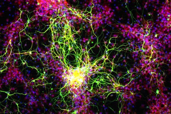 New gene therapy possibility for DR, glaucoma