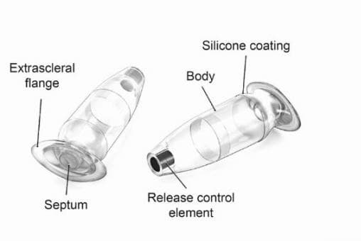 New AMD reservoir implant