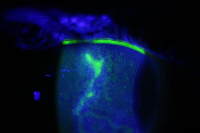 CCLS Photo Comp Third Land Of The Long Herpes Ulcer (2)