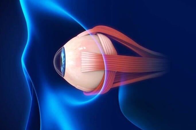 Glaucoma - brain degeneration link
