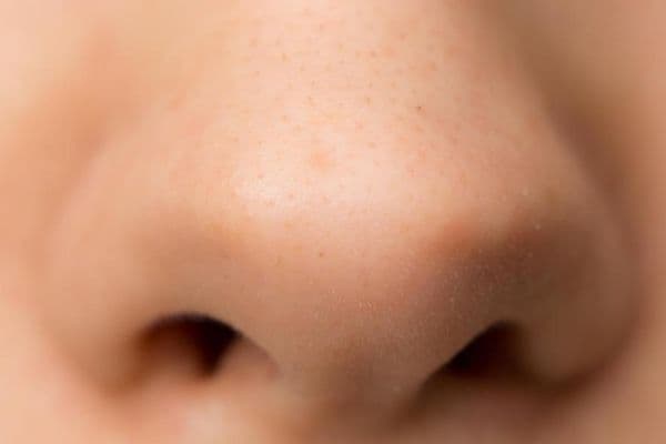 Loss of smell ‘first sign’ of covid-19