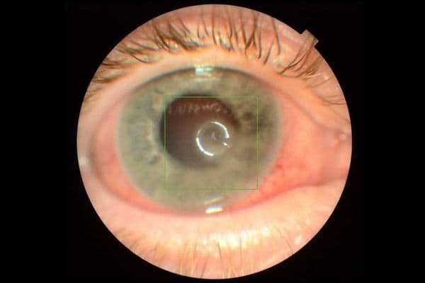 Case study: Steroids and strimmers