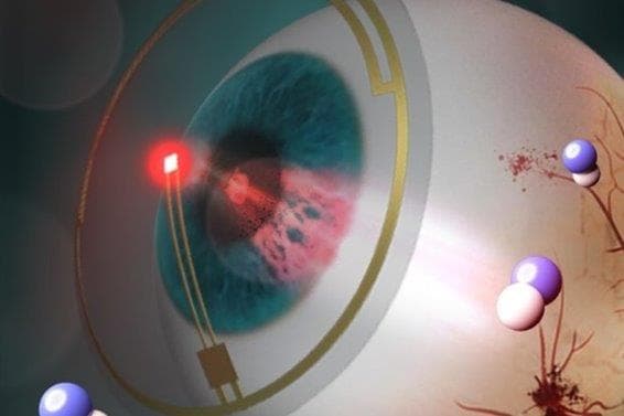 LED lens prevents DR (1)