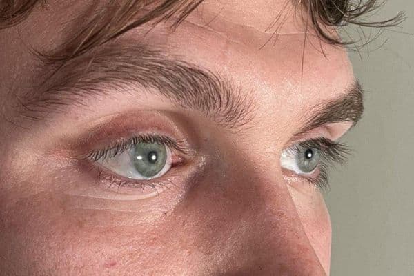 artififical eye small