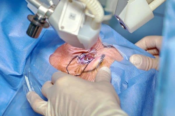 Cefuroxime irrigation to combat endophthalmitis