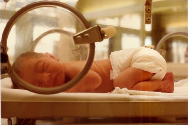 Low birth weight linked to eye problems
