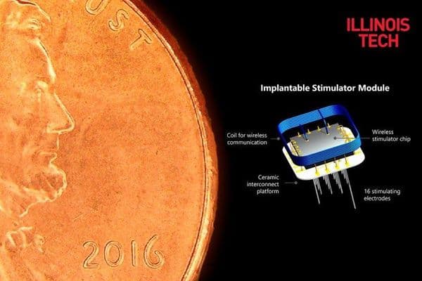 New artificial vision system implanted