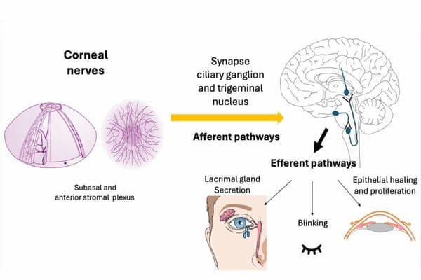 Understanding and treating corneal nerve dysfunction
