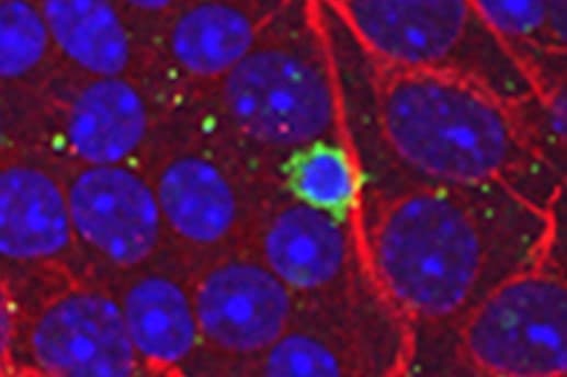 Immune response contributes to glaucoma?