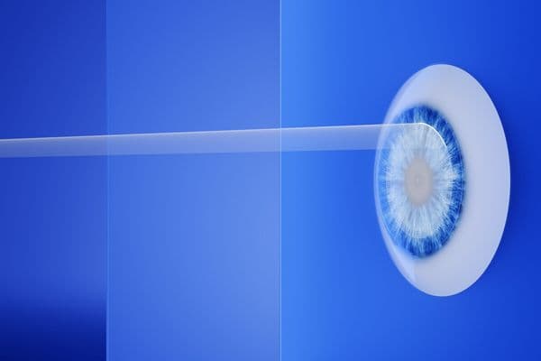 zmvdgasd zeiss hyperopia indication smile pro