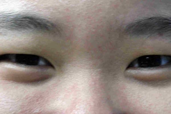 China deploys AI fundus scans
