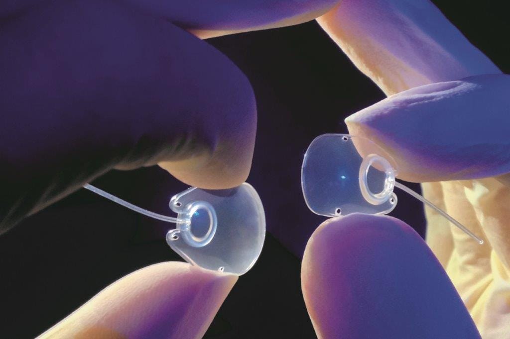 Molteno sold to Nova Eye Medical