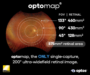 Optos Advertisement - Saving Sight