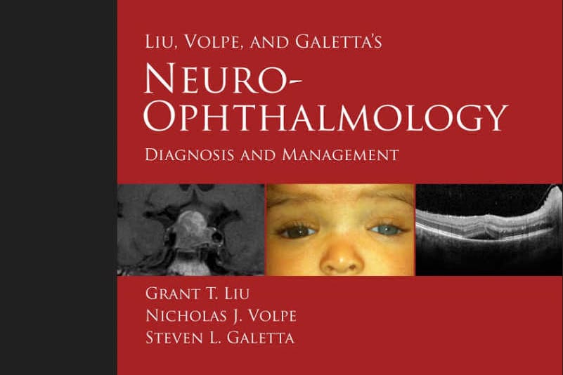 Book review: Liu, Volpe, and Galetta’s Neuro-Ophthalmology: Diagnosis and Management, 3rd Edition