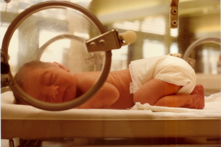 Low birth weight linked to eye problems