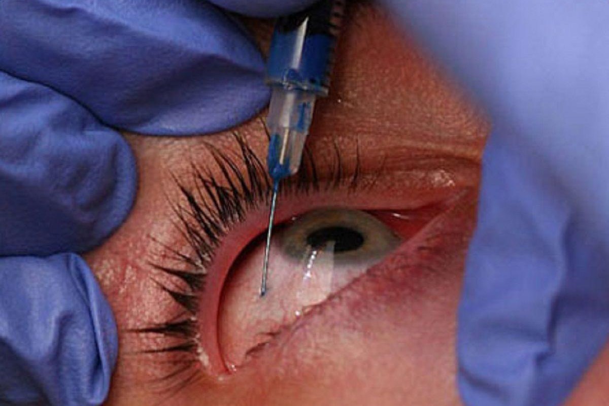 Retina research review