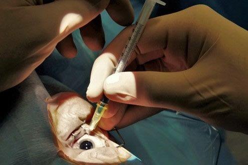 Intravitreal injections and iatrogenic dry eye